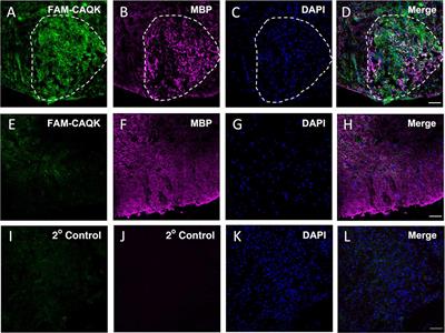CAQK, a peptide associating with extracellular matrix components targets sites of demyelinating injuries